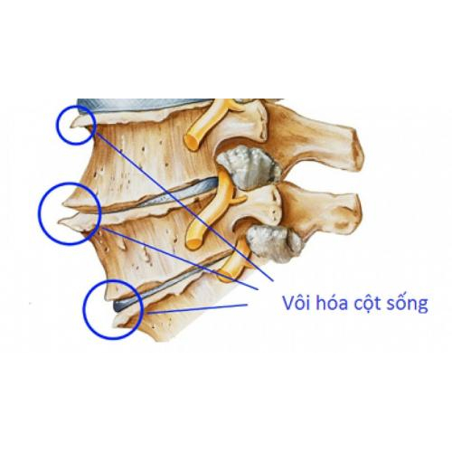 Đau vai gáy "dai dẳng" không khỏi? Cẩn thận 7 "thủ phạm" nguy hiểm này!